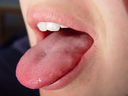 What Is Tongue Diagnosis In Chinese Medicine Ping Ming Health
