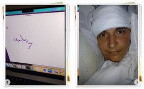 ORANG PERTAMA DI DUNIA Menulis dengan Pikiran! Ternyata di Kepala Audrey  Crews Ada Chip Otak Elon Musk