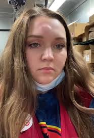 3 years ago I got a cartoon bump from a can of soup hitting me in the head  from the top shelf 😭💀