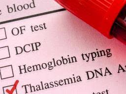 Thalassemia Types Symptoms And Treatment