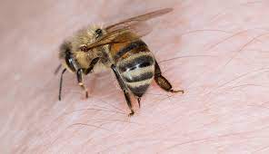 Bienenstich Was Tun Eine Arztin Klart Auf