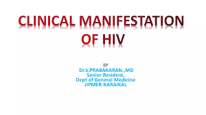 Image result for HIV Presentation