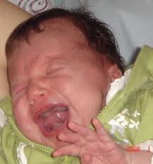 Den frühkindlichen autismus und das. Babyschreie Liefern Fruhen Hinweis Auf Autismus Wissenschaft Aktuell