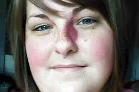 Fundraiser for Allison Claeys by Sarah Place-Minshall : Allison Claeys's  House Fire Fund