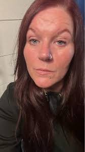 Electric Forest Safety Concerns and Intervention