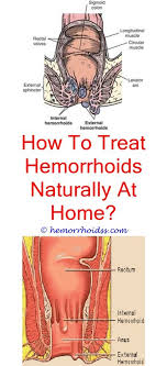 How To Help Hemorrhoids Bleeding Hemorrhoids Cure For Hemorrhoids Hemorrhoids