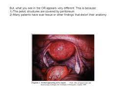 Relevance to continence preservation following major pelvic surgery. Pelvic Anatomy From The Laparoscopic Perspective Ppt Video Online Download