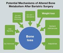 Mayo Clinic Bmi Calculator Mayo Clinic Diet Plan Review