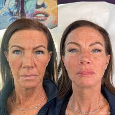 Collin Wang, BSN, RN