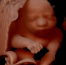Collage of medical images of ultrasound anomaly scan on a female fetus 20 weeks into the pregnancy, showing child's hand, head, feet, legs, spine and human fetus age 20 weeks, illustration. 22 Week 3d Ultrasound Pictures A Date With Baby