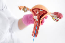 Image result for Friable Cervix