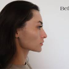 DR SEAN PLASTIC SURGERY