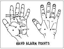 20 described acupuncture alarm points chart