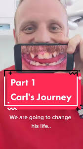Carl Roepke Teeth Before and After