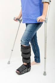 An avulsion fracture is a bone fracture which occurs when a fragment of bone tears away from the main mass of bone as a result of physical trauma. Foot Avulsion Fracture Treatment Information Legal Options