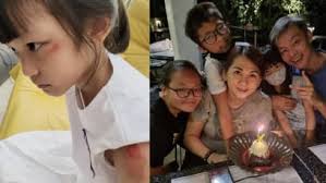 4-Year-Old Son Of Taiwanese Singer Accidentally Swallowed A Coin & It Got  Stuck In His Throat