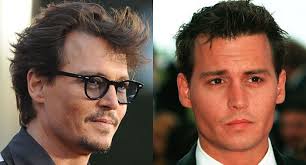 His acting skills have made him an icon, but that's not all. Johnny Depp Hair Transplant Revelations His Hair Clinic