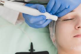 Fibroblast Plasma Skin Tightening Laguna Niguel Fibroblast Orange County Skin Treatment