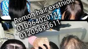 Remon Hair Extensions تركيب شعر مسيو ريمون الجزائر Vlip Lv