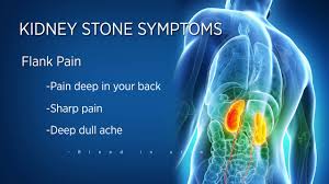 What It S Like To Get A Kidney Stone Ultrasound Youtube