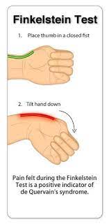 Finkelstein's test (preferred, higher test specificity). Medicole On Twitter Finkelstein S Test De Quervain S Tenosynovitis Physical Rheum Meded Foamed Http T Co J9hvuz0lus