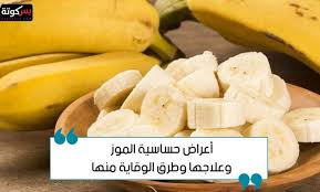 أعراض حساسية الموز وعلاجها وطرق الوقاية منها Banana Food Fruit
