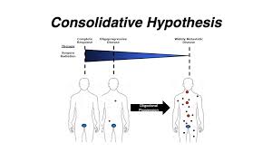 Since the cancer cells originated in the prostate gland, the cancer is referred to as metastatic prostate cancer. Intense Form Of Radiation Slows Disease Progression In Some Men With Prostate Cancer That Has Spread