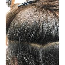 Here Are 7 Myths About Lice That Should Know About Head Louse Lice Removal Head Lice Removal