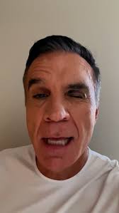 Walking into a glass wall update!! I went to see a doctor just to make sure  I hadn't broken or smashed my suborbital ridge. I didn't. But, it feels  like I've had a mommy make over with an eyeliner ...