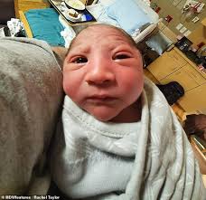 Mother of baby boy born with a tiny head reveals doctors thought her labour  was to blame