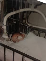 Kartal Bebek Ve Onun Gibiler Icin Dua Vakti Insaninsanaemanettir