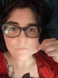 Would y'all mind letting me know if my skin seems hyper-elastic? I feel  like it's super obvious when I'm looking at other folks but have no idea  when it comes to me.