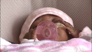 It can take a little while for babies bodies' to catch up and be proportionate with their head. Miracle Baby Born At Just 10 Ounces Finally Gets To Go Home Abc News