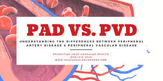 understanding the differences between pad vs pvd usa