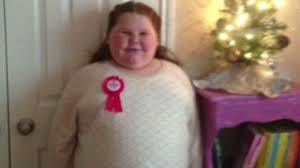 Image result for OBESITY GIRLS