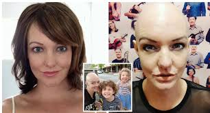 Mum-of-two reveals what it's like to live with alopecia