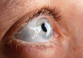 Image result for Cornea