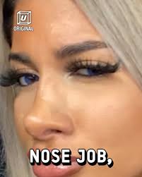 My nose job took several surgeries... 🫣 💁‍♀️✨