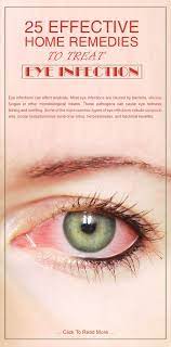 10 Proven Home Remedies For Eye Infections Eye Infections Skin Care Pimples Eye Sight Improvement