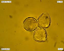 Image result for Millettia eetveldeana