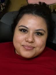 Facial balancing by me 💋 Arlington! Packages start at $600 Summer sale  price