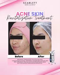 Emang ada yah cewe yang ga suka bunga?🤔 Bunga sendiri melambangkan  kecantikan dan identik sama perempuan. Dari bunga kita bisa buat kreasi  dalam banyak hal, salah satunya adalah merangkai bunga💐 Ada kabar