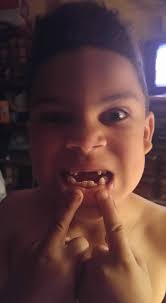 Is your child losing teeth and asking about the tooth fairy?