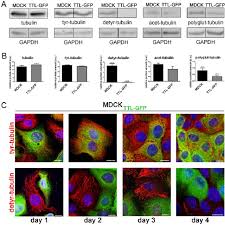 Ttl colombian models 20.039 views11 months ago. Ttl Overexpression Depletes Detyrosinated Microtubules A Lysates Of Download Scientific Diagram