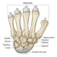 Image result for Scaphoid Fracture
