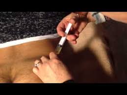 Image result for infermieristica come fare l'iniezione