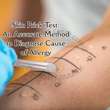 Image result for Skin Testing
