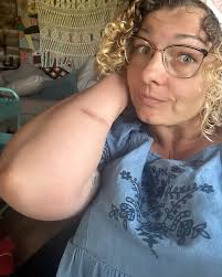 Do you want to see my workman's comp claim? 😂 This is some kind of  pressure bruise