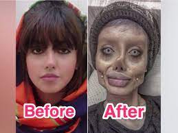 Plastic (cosmetic) surgery (2020)hi fam: Iran Influencer Who Underwent Dozens Of Cosmetic Surgeries Arrested