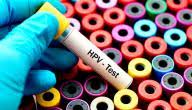 Hpv (human papillomavirus) is a virus that can cause certain cancers in males and females later in life. ÙƒÙŠÙÙŠØ© Ø¹Ù„Ø§Ø¬ ÙÙŠØ±ÙˆØ³ Ø§Ù„ÙˆØ±Ù… Ø§Ù„Ø­Ù„ÙŠÙ…ÙŠ Ø§Ù„Ø¨Ø´Ø±ÙŠ Ù…ÙˆØ¶ÙˆØ¹